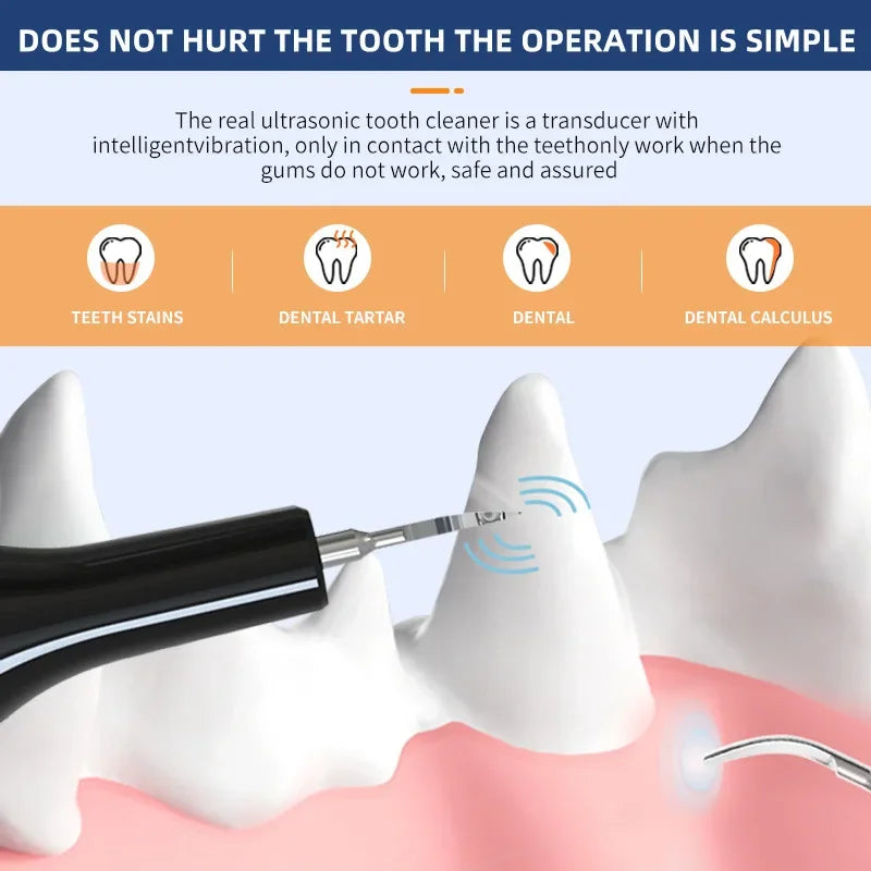 Ultrasonic Portable Electric Dog Toothbrush- Professional Plaque Calculus Removal- Teeth Whitening for Pet Dental Care-Pet Grooming